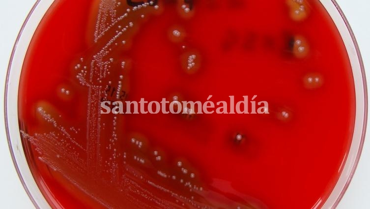 Streptococcus pyogenes. Una imagen de la bacteria.