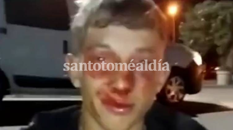 Un joven de nuestra ciudad fue brutalmente golpeado por patovicas