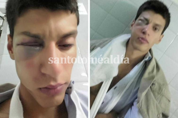 Brutal agresión a un joven de Sauce Viejo dentro de un boliche
