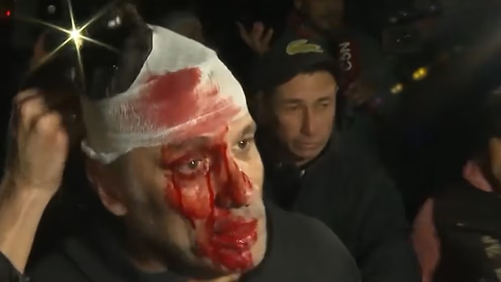 Cristian Mercatante fue agredido por un grupo de jóvenes. (Crédito: Infobae)